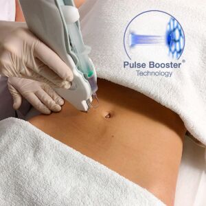 Cellulite, Anti Cellulite, Fettweg, abnehmen, Umfang reduzieren, Körperwickel, Mesotherapie, Mesoject Gun, nadellos, Toskani, Anti Aging, Ästhetische Kosmetik, Fett absaugen, Fettweg Spritze, Cellulitis