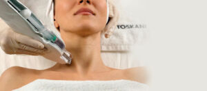 Mesotherapie, Mesoject Gun, nadellos, Toskani, Anti Aging, Ästhetische Kosmetik
